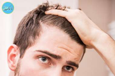 ریزش مو ریزش مو