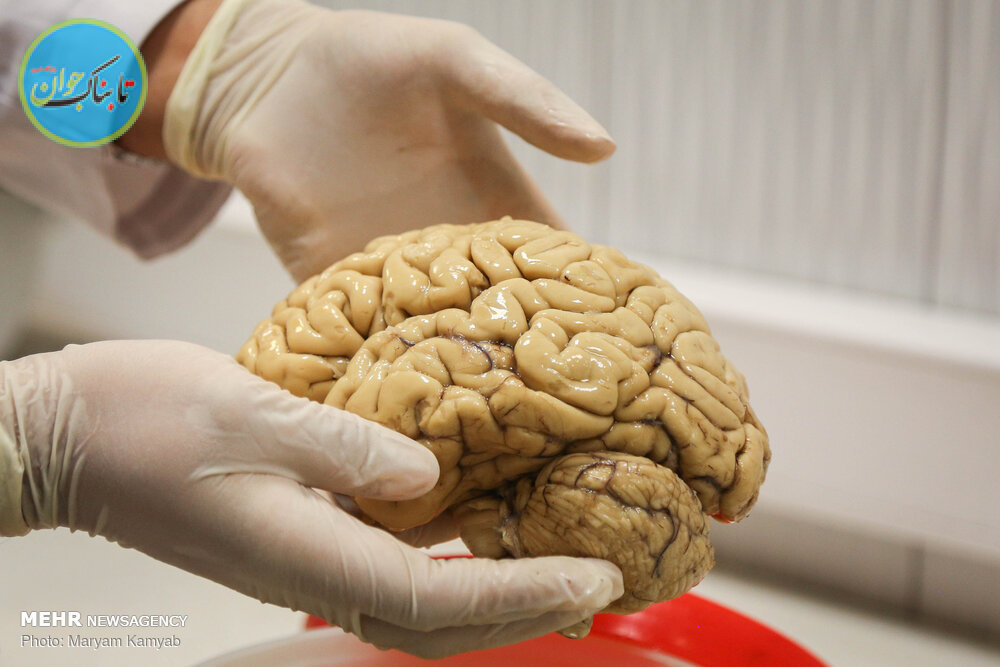 بانکی که که مغز وام می دهند! بانکی که که مغز وام می دهند!